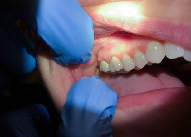 Best Emergency Root Canal Treatment in Amity Gardens, PA