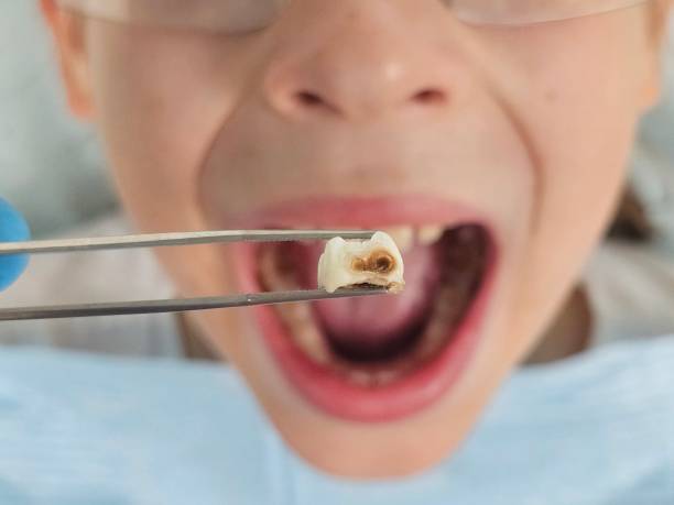 Best Emergency Dentist for Lost Fillings or Crowns in Amity Gardens, PA